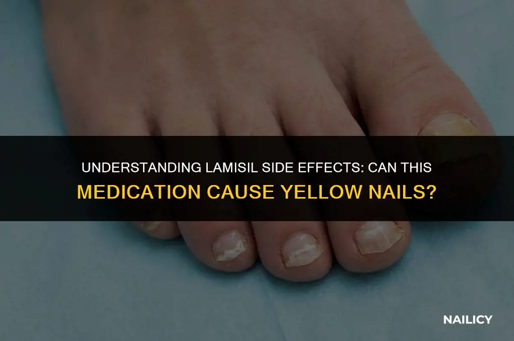 can my nails turn yellow with lamisil
