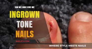 Can Your Shoe Cause Ingrown Toenails? Expert Insights