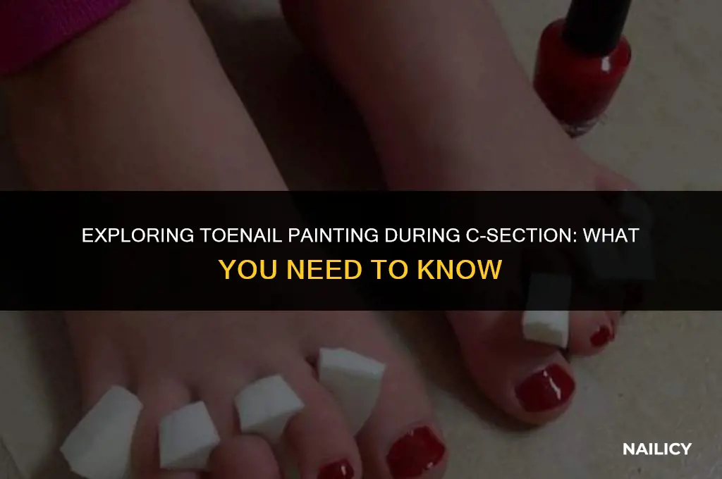 can my toe nails be painted during a c-section