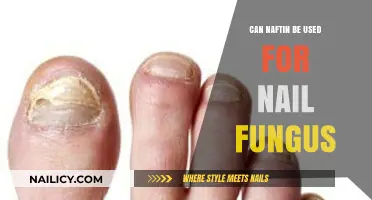 Exploring Naftin's Efficacy Against Nail Fungus: A Comprehensive Guide