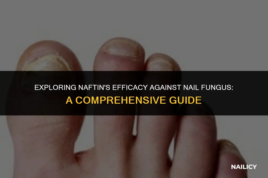 can naftin be used for nail fungus