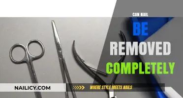 Complete Nail Removal: Is It Possible?