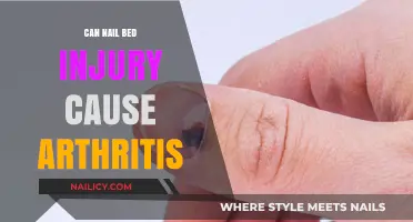 Exploring the Link: Can Nail Bed Injuries Lead to Arthritis?
