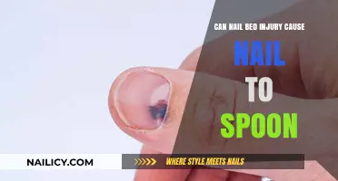 Exploring the Link: Nail Bed Injuries and Spoon-Shaped Nails
