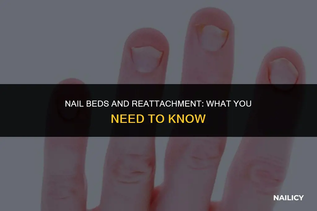can nail beds reattach