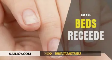 Understanding Nail Bed Recession: Causes, Prevention, and Treatment Options