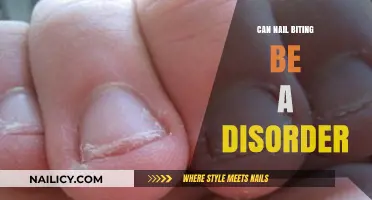 Exploring the Hidden Struggles: Is Nail Biting a Disorder?