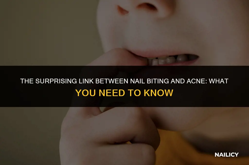 can nail biting cause acne