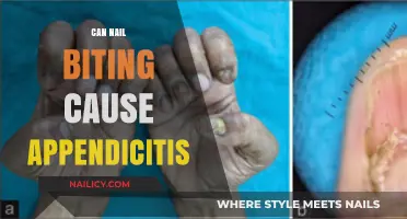 The Surprising Link Between Nail Biting and Appendicitis: What You Need to Know