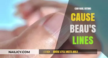 Nail Biting and Beau's Lines: Understanding the Connection