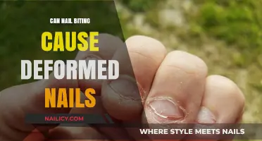 The Surprising Truth About Nail Biting and Deformed Nails