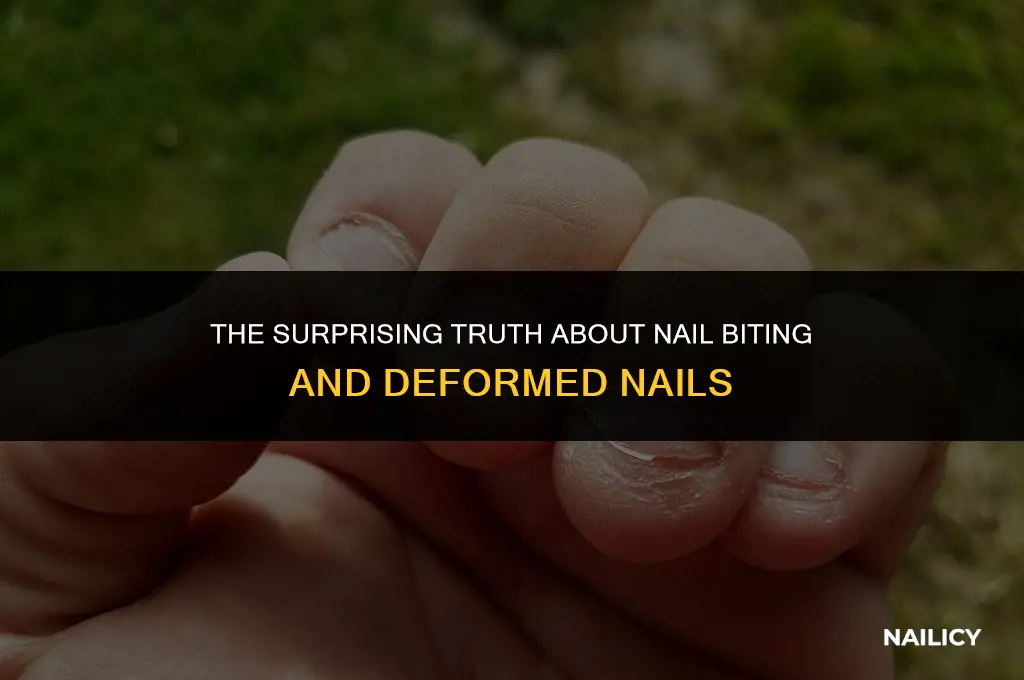 can nail biting cause deformed nails