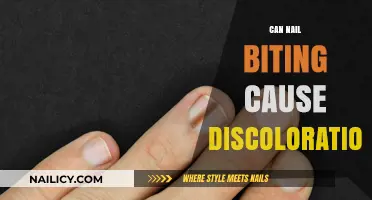 The Surprising Link Between Nail Biting and Discoloration: Facts Revealed