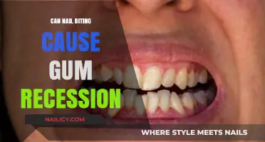 The Surprising Link Between Nail Biting and Gum Recession