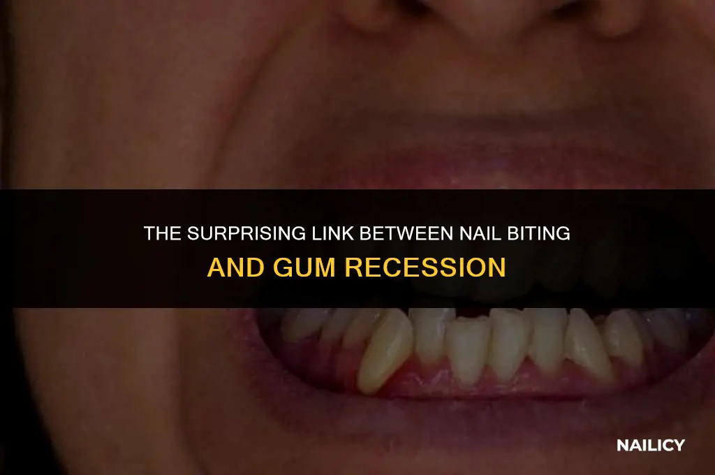 can nail biting cause gum recession