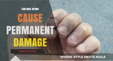 The Surprising Truth About Nail Biting: Permanent Damage Explained