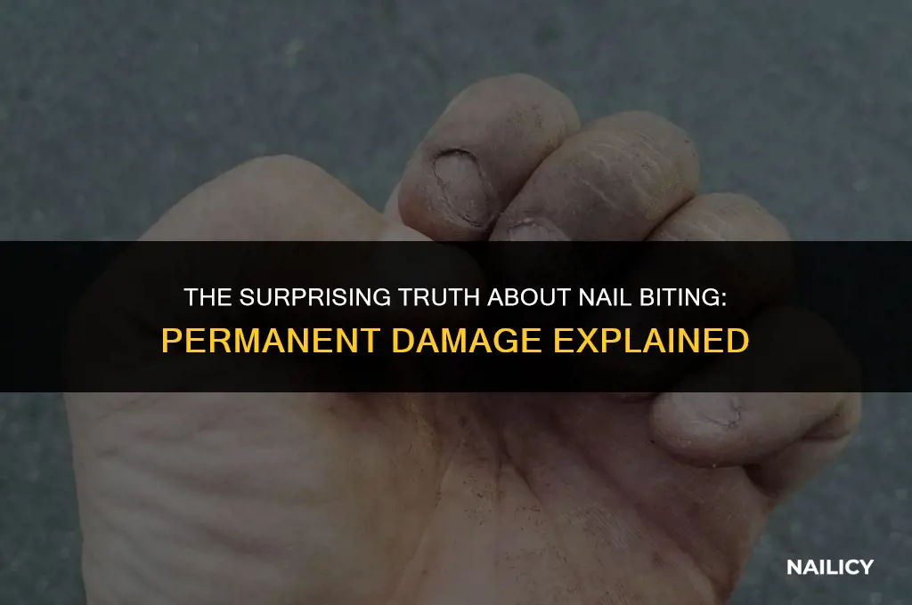 can nail biting cause permanent damage