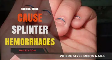 The Surprising Link Between Nail Biting and Splinter Hemorrhages