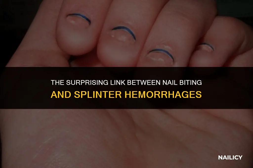 can nail biting cause splinter hemorrhages