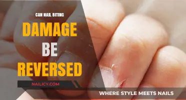 Reversing Nail Biting Damage: Tips for Healthy Nails