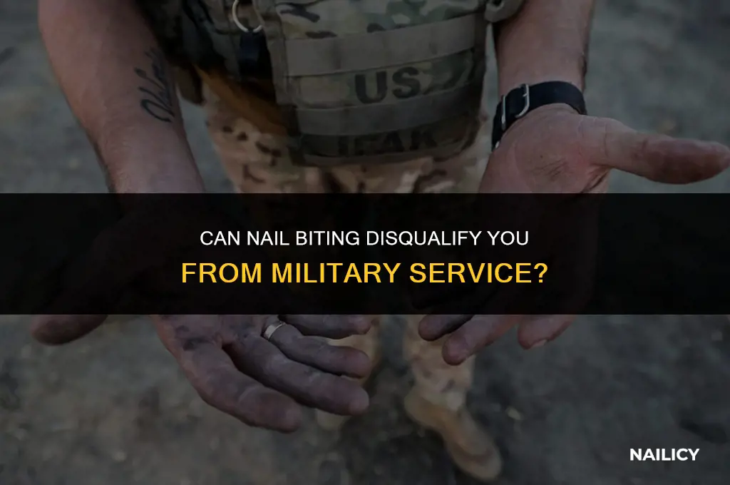 can nail biting disqualify from military