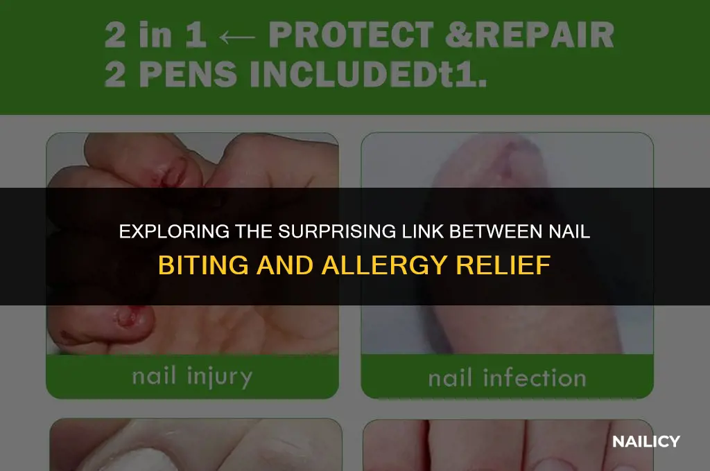 can nail biting help allergies