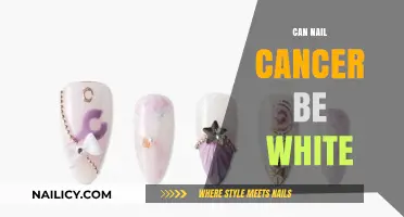 Unveiling the Truth: Can Nail Cancer Appear White?