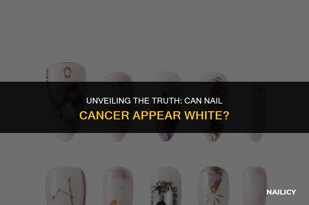 can nail cancer be white