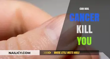 Understanding Nail Cancer: Risks, Symptoms, and Treatment Options