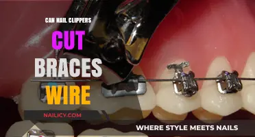 Snipping Through Orthodontic Wires: Can Nail Clippers Cut Braces?