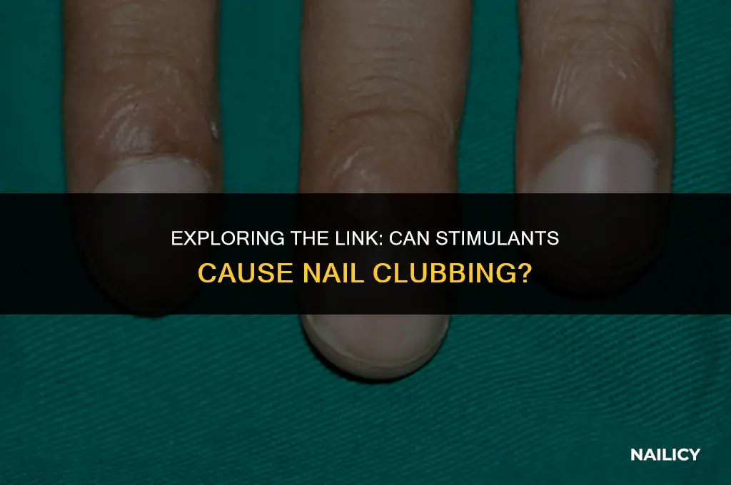 can nail clubbing be caused by stimulants