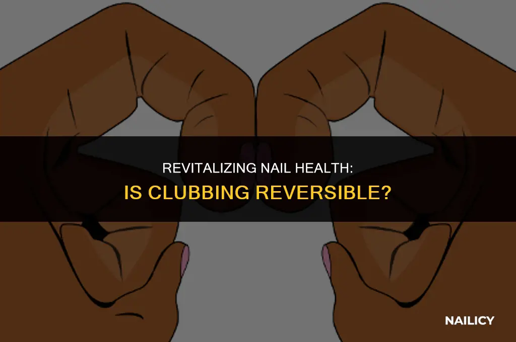 can nail clubbing be cured