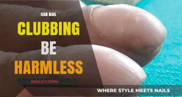 Exploring the Myths: Can Nail Clubbing Ever Be Harmless?