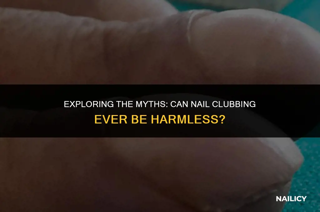 can nail clubbing be harmless