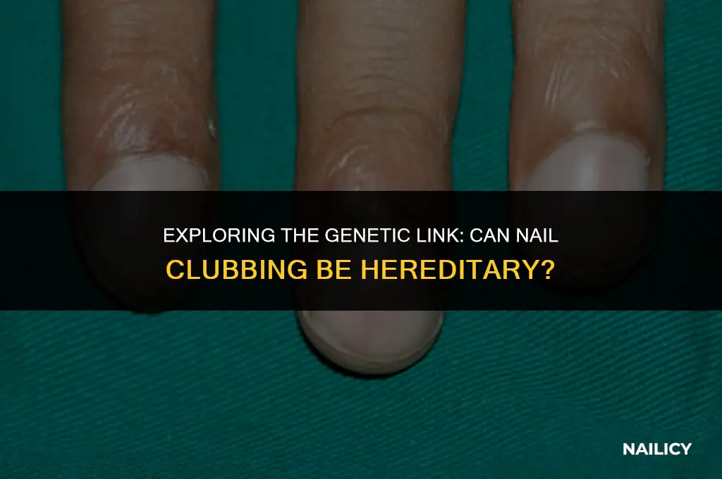 can nail clubbing be hereditary