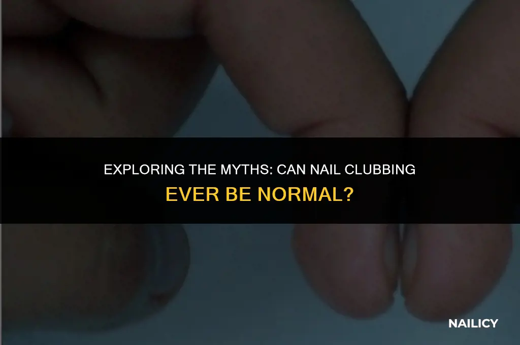 can nail clubbing be normal