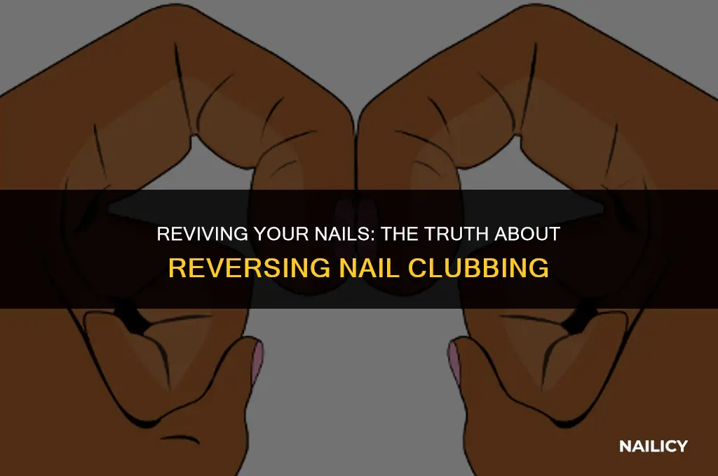 can nail clubbing be reversed