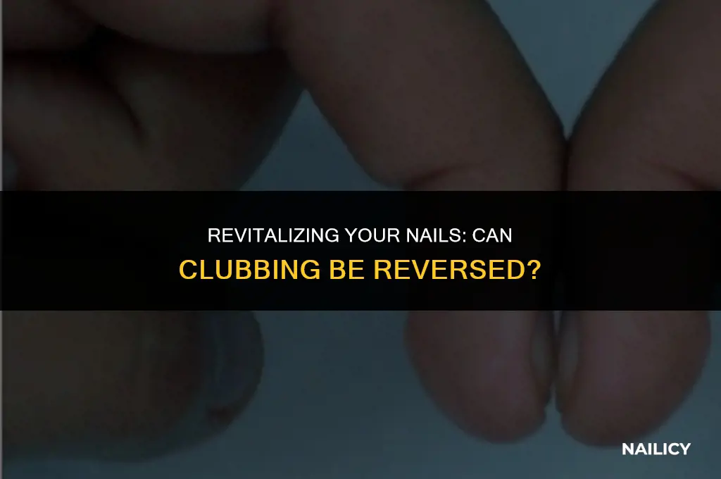 can nail clubbing go away