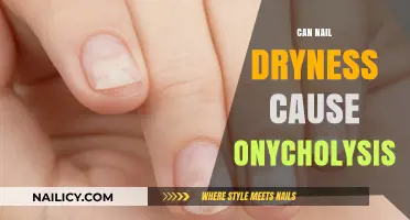 Exploring the Link Between Nail Dryness and Onycholysis: Facts and Prevention Tips