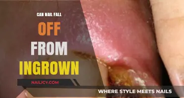 Understanding Ingrown Toenails: Can Your Nail Really Fall Off?