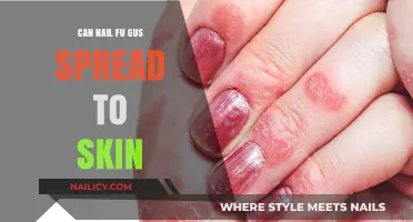 Can Nail Fungus Spread to Skin: Facts and Prevention Tips