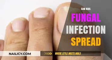Can Nail Fungal Infections Spread? Understanding the Risks and Prevention