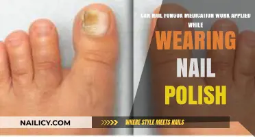Nail Polish and Fungus Treatment: Can They Coexist Effectively?