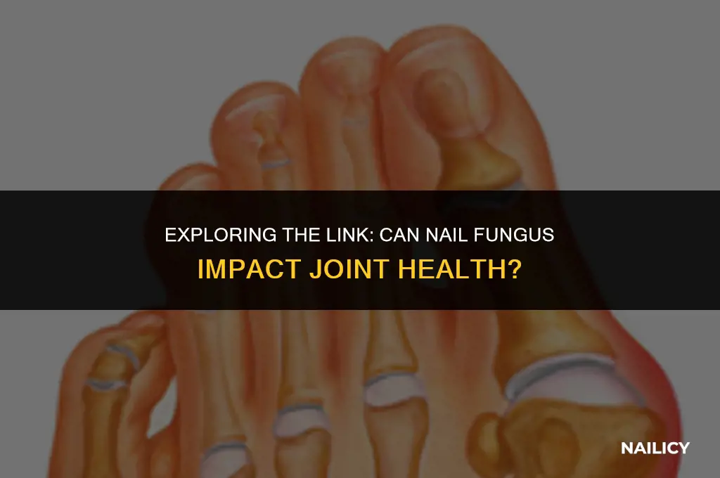 can nail fungus affect joints