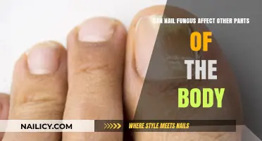 Exploring the Reach of Nail Fungus: Can It Affect Other Body Parts?