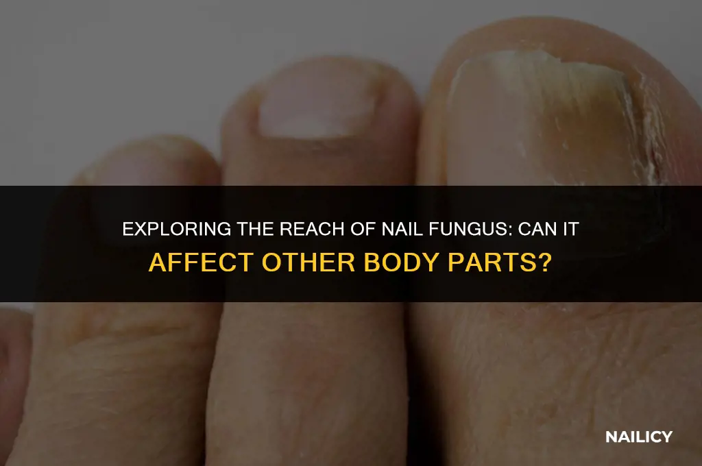 can nail fungus affect other parts of the body