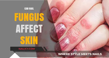 Unveiling the Truth: Nail Fungus and Its Impact on Skin Health