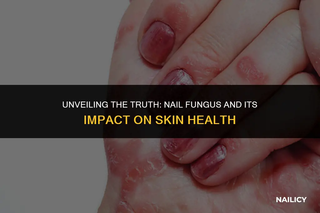 can nail fungus affect skin