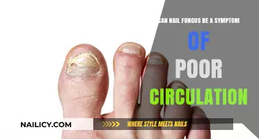 Exploring the Link: Nail Fungus and Poor Circulation Symptoms