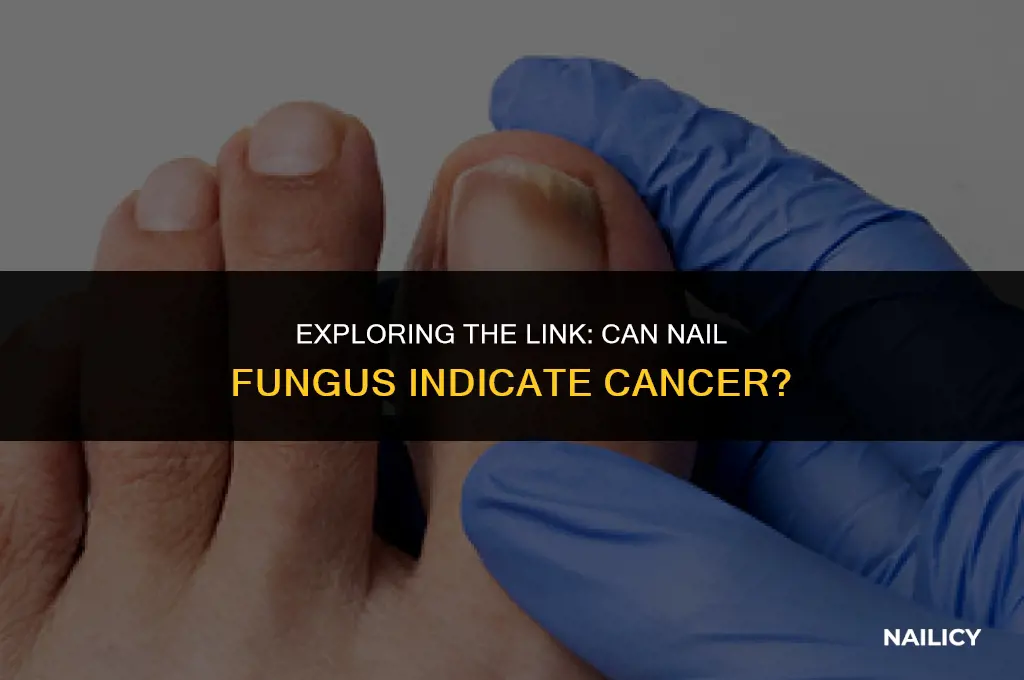 can nail fungus be cancer